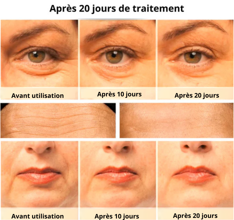 VENCIA™ Santé, appareil de lifting 7 en 1